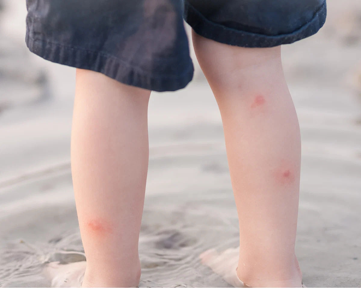The Nude Alchemist Bug Bite Balm