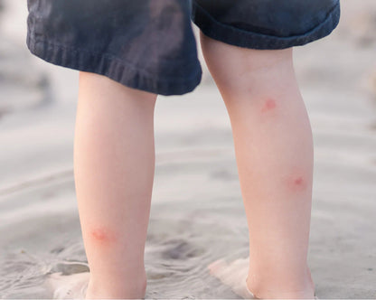 The Nude Alchemist Bug Bite Balm