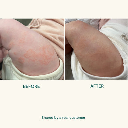 BEETL Baby Cream 250ml