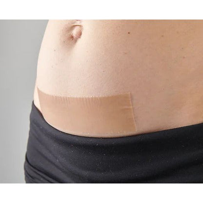 Myscar Caesarean Silicone Strips - The Original