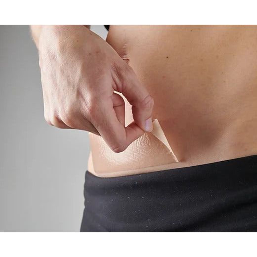 Myscar Caesarean Silicone Strips - The Original