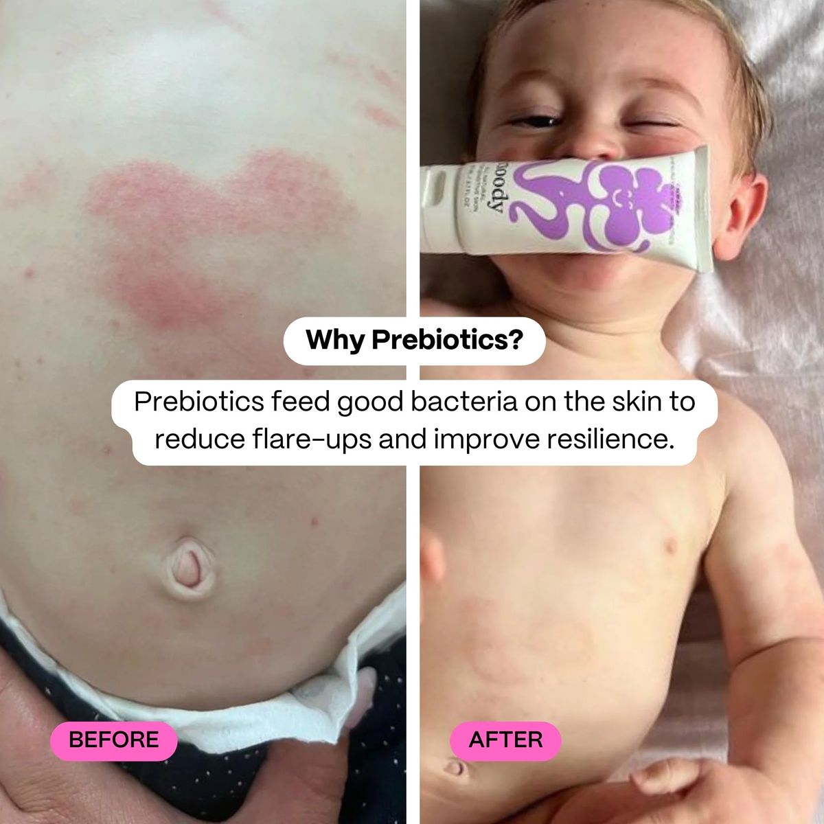 Noody Calm Balm - Healing Balm with Prebiotics 80ml