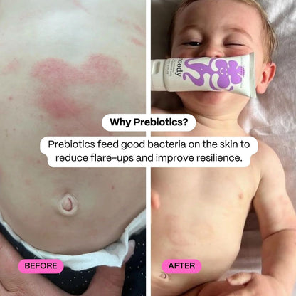 Noody Calm Balm - Healing Balm with Prebiotics 80ml