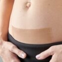 C-Section Guide